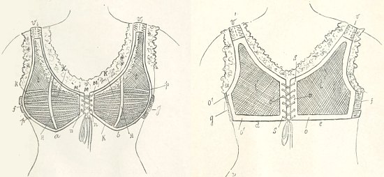 Le modèle de corselet-gorge proposé par Herminie Cadolle. Schéma extrait de Le corset, histoire, médecine, hygiène. Étude historique (1905)