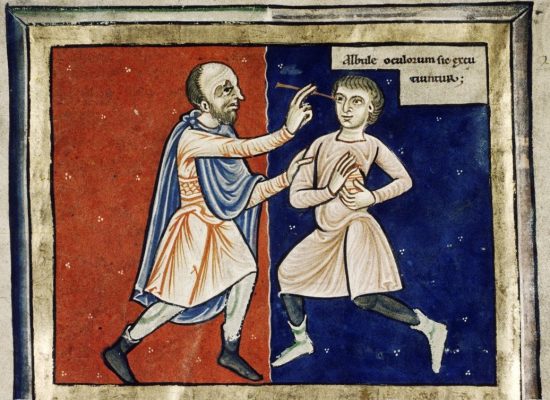 Opération de la cataracte. Enluminure anglaise du XIIe siècle
