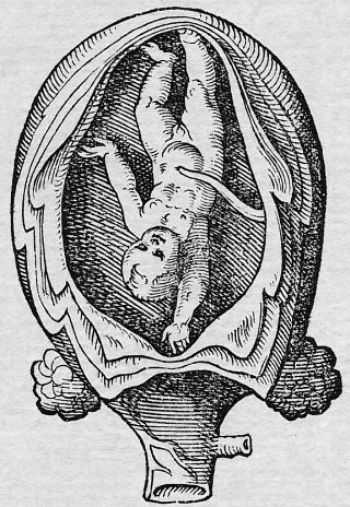 Foetus (par le médecin suisse Jakob Rüff, XVIe siècle)