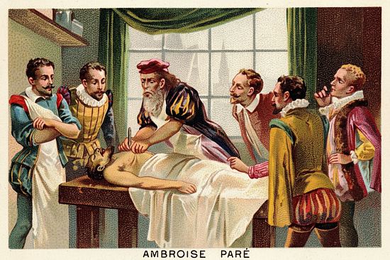 Ambroise Paré opérant sur un patient. Chromolithographie publiée vers 1890