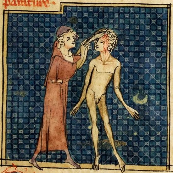 Le chirurgien incise le front d'un malade. Enluminure extraite du manuscrit français n°2030 de la BnF écrit en 1314 et contenant la Cyrurgie de maistre Henri de Mondeville ainsi que Chapitre de la doctrine artificielle de faire incisions