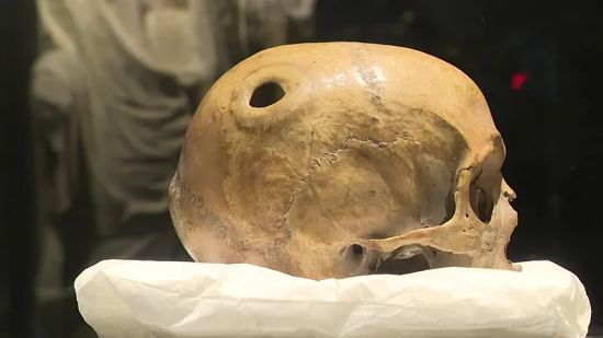 Le crâne de Saint Aubert, l'évêque d'Avranches fondateur du Mont Saint Michel