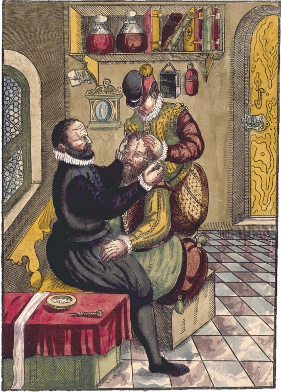 Opération de la cataracte. Gravure extraite de Ophthalmodulea. Das ist Augendienst de Georg Bartisch, paru en 1583