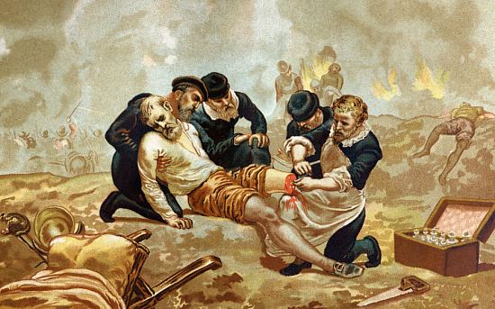 Ambroise Paré pratique la ligature des artères après une amputation, lors de la bataille de Damvillers, près de Verdun, où les troupes d'Henri II tentent de prendre d'assaut la forteresse occupée par les forces impériales de Charles Quint. Chromolithographie publiée vers 1880