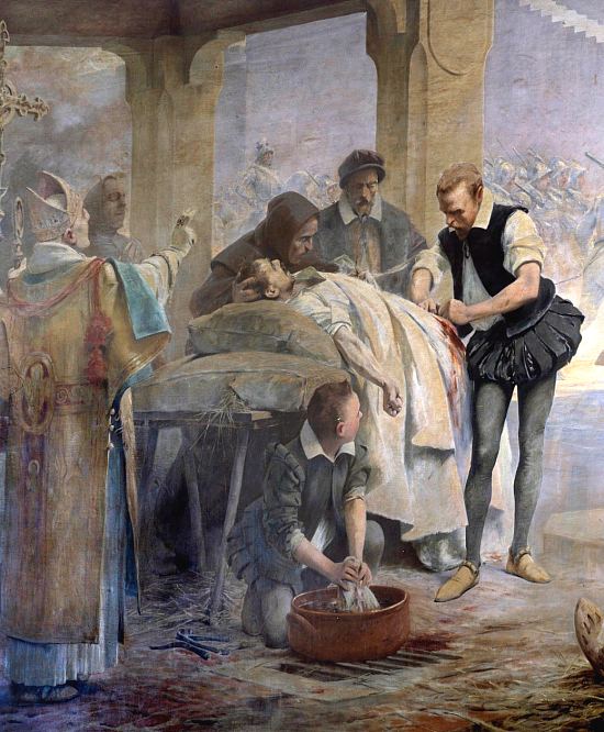 Ambroise Paré pratique la ligature des artères sur un arquebusier blessé lors du siège de Metz par Charles Quint en 1553. Détail d'une peinture de Théobald Chartran (1888)
